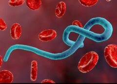 EBOLA ET MARBURG : RÉFLEXION À HAUTE VOIX SUR DEUX FLÉAUX QUI INTERPELLENT NOTRE NATION