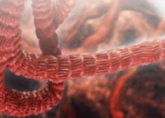 RDC/Épidémie d&rsquo;Ebola : 70 millions USD manquent au budget de la riposte.